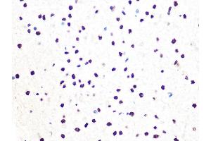 Immunohistochemistry of paraffin-embedded rat brain using DDB1 Rabbit mAb (ABIN7266673) at dilution of 1:100 (40x lens).