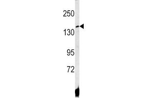 Western Blotting (WB) image for anti-ATPase, Cu++ Transporting, beta Polypeptide (ATP7B) antibody (ABIN3002647)
