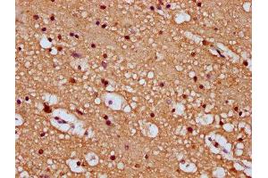 IHC image of ABIN7168823 diluted at 1:100 and staining in paraffin-embedded human brain tissue performed on a Leica BondTM system.