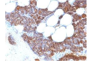 Formalin-fixed, paraffin-embedded human Parathyroid Gland stained with PTH-Monospecific Recombinant Rabbit Monoclonal Antibody (PTH/2295R). (Recombinant PTH anticorps  (AA 32-115))
