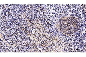 Detection of ANXA1 in Porcine Lymph node Tissue using Polyclonal Antibody to Annexin A1 (ANXA1)