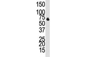 Western blot analysis of BMPR1B antibody and NCI-H460 cell lysate.