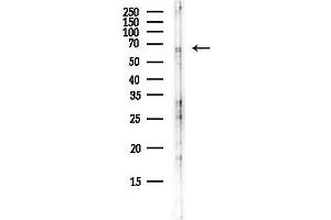 Western blot analysis of lysates from F10-LUC cells(starvation,24h treatment), using RFX5 Antibody at 1/1000 dilution.