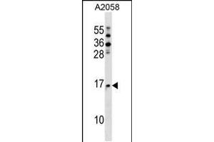 Western blot analysis in A2058 cell line lysates (35ug/lane). (NAT5 anticorps  (C-Term))