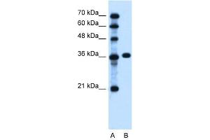 WB Suggested Anti-PTCH1 Antibody Titration:  0. (Patched 1 anticorps  (C-Term))