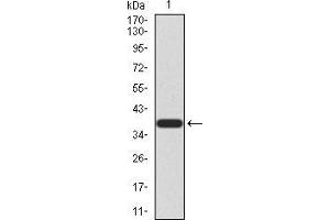 Western blot analysis using CBX2 mAb against human CBX2 (AA: 402-525) recombinant protein. (CBX2 anticorps  (AA 402-525))