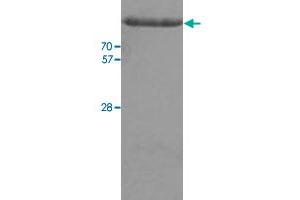 Hexokinase 2 Protein (HK2) (AA 1-917) (His tag)