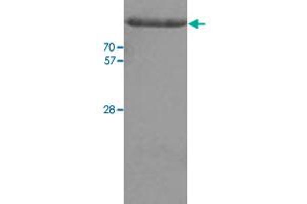 Hexokinase 2 Protein (HK2) (AA 1-917) (His tag)
