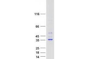 Validation with Western Blot