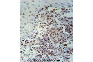 Immunohistochemistry (IHC) image for anti-X-Ray Repair Complementing Defective Repair in Chinese Hamster Cells 1 (XRCC1) antibody (ABIN3002379) (XRCC1 anticorps)