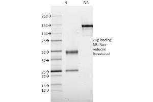 SDS-PAGE Analysis Purified Thyroid Peroxidase Mouse Monoclonal Antibody (TPO/1921). (TPO (AA 685-804) anticorps)