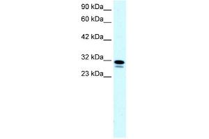 WB Suggested Anti-SSBP2 Antibody Titration: 0. (SSBP2 anticorps  (N-Term))