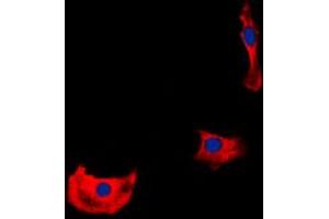 Immunofluorescent analysis of HER4 staining in HepG2 cells. (ERBB4 anticorps  (C-Term))