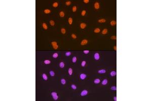 Immunofluorescence analysis of U-2 OS cells using SUMO4 Rabbit mAb (ABIN7270372) at dilution of 1:100 (40x lens).