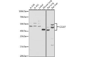 Western blot analysis of extracts of various cell lines, using CD207 antibody (ABIN6131544, ABIN6138141, ABIN6138142 and ABIN6222222) at 1:1000 dilution. (CD207 anticorps  (AA 69-328))