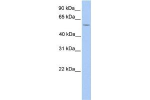 WB Suggested Anti-LIMD1 Antibody Titration:  1 ug/ml  Positive Control:  HepG2 cell lysate LIMD1 is supported by BioGPS gene expression data to be expressed in HepG2 (LIMD1 anticorps  (N-Term))