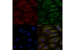 ABIN6265115 and ABIN6276896 staining  cells by IF/ICC.