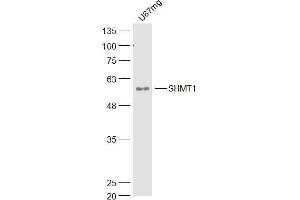 U87MG lysates probed with SHMT1 Polyclonal Antibody, Unconjugated  at 1:300 dilution and 4˚C overnight incubation. (SHMT1 anticorps  (AA 301-400))