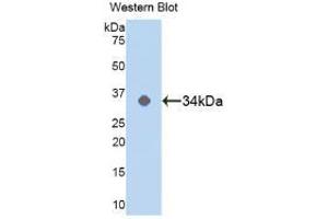 Western blot analysis of the recombinant protein. (MAPK14 anticorps  (AA 19-279))