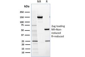 SDS-PAGE Analysis Purified NRF1 Mouse Monoclonal Antibody (NRF1/2609).