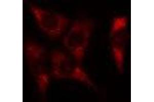 ABIN6278584 staining Hela cells by IF/ICC. (JTB anticorps  (Internal Region))