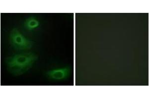 Immunofluorescence analysis of HeLa cells, using 5-HT-1B Antibody. (5HT1B Receptor anticorps  (AA 201-250))