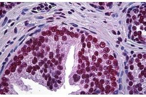 Human Prostate: Formalin-Fixed, Paraffin-Embedded (FFPE) (LHX4 anticorps  (AA 291-390))