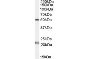 ABIN334340 (1µg/ml) staining of Human Brain (Substantia nigra) lysate (35µg protein in RIPA buffer). (Acylglycerol Kinase anticorps  (C-Term))