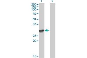 Western Blot analysis of C1QA expression in transfected 293T cell line by C1QA MaxPab polyclonal antibody. (C1QA anticorps  (AA 23-245))