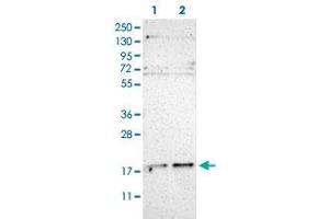 Western Blot (Cell lysate) analysis of (1) Human RT-4 cell and (2) Human U-251MG sp cell. (UBE2G2 anticorps)
