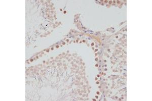 Immunohistochemistry of paraffin-embedded rat testis using Cyclin G1 antibody (ABIN6127734, ABIN6138095, ABIN6138096 and ABIN6220906) at dilution of 1:100 (40x lens). (Cyclin G1 anticorps  (C-Term))