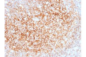 Formalin-fixed, paraffin-embedded human Tonsil stained with CD73 Mouse Monoclonal Antibody (NT5E/2545).