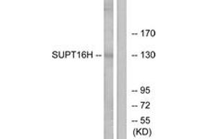 Western blot analysis of extracts from HepG2/Jurkat cells, using SUPT16H Antibody. (SUPT16H anticorps  (AA 941-990))