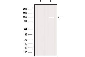 Western blot analysis of extracts from Mouse brain, using VAV1 Antibody.