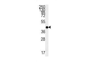 MC2R Antibody (C-term) (ABIN651731 and ABIN2840379) western blot analysis in WiDr cell line lysates (15 μg/lane).