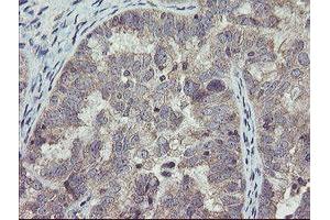 anti-rho GTPase Activating Protein 2 (ARHGAP2) antibody