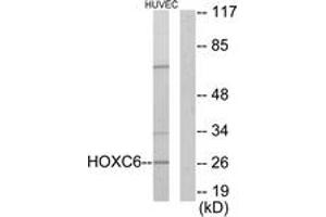Western blot analysis of extracts from HuvEc cells, using HOXC6 Antibody. (Homeobox C6 anticorps  (AA 186-235))
