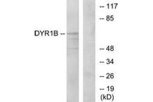 Western Blotting (WB) image for anti-Dual-Specificity tyrosine-(Y)-phosphorylation Regulated Kinase 1B (DYRK1B) (AA 331-380) antibody (ABIN2889828)