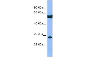 Host: Rabbit Target Name: C22orf13 Sample Type: RPMI-8226 Whole Cell lysates Antibody Dilution: 1. (C22orf13 anticorps  (Middle Region))