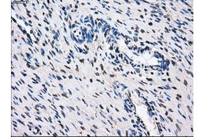 Immunohistochemical staining of paraffin-embedded Ovary tissue using anti-GBE1 mouse monoclonal antibody. (GBE1 anticorps)