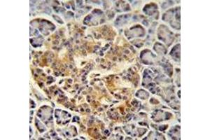 Immunohistochemistry analysis in human pancreas tissue (Formalin-fixed, Paraffin-embedded) using Trypsin-3 / PRSS3  Antibody  (N-term), followed by peroxidase conjugation of the secondary antibody and DAB staining.