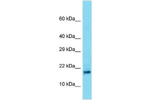 Host: Rabbit Target Name: C8orf42 Sample Type: Placenta lysates Antibody Dilution: 1. (TDRP/C8orf42 anticorps  (N-Term))