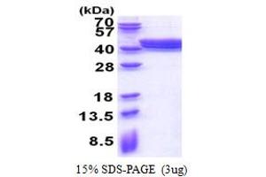 SDS-PAGE (SDS) image for Pleckstrin Homology Domain Containing, Family F (With FYVE Domain) Member 2 (PLEKHF2) (AA 1-249) protein (His tag) (ABIN5853556)