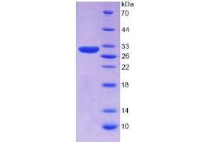 SDS-PAGE of Protein Standard from the Kit (Highly purified E. (SERPINB3 Kit CLIA)