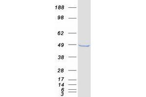 Validation with Western Blot