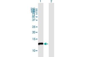 anti-NADH Dehydrogenase (Ubiquinone) 1 alpha Subcomplex, 5, 13kDa (NDUFA5) (AA 1-116) antibody