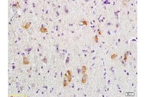 Formalin-fixed and paraffin embedded rat brain tissue labeled with Anti-APC/Adenomatous Polyposis Coli Polyclonal Antibody, Unconjugated  at 1:200 followed by conjugation to the secondary antibody, (SP-0023), and DAB staining