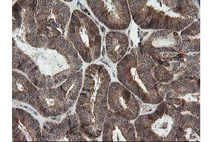 Image no. 5 for anti-Mitochondrial Ribosomal Protein S34 (MRPS34) antibody (ABIN1499564)