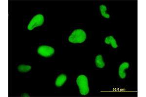 Immunofluorescence of monoclonal antibody to ZNF207 on HeLa cell. (ZNF207 anticorps  (AA 1-110))