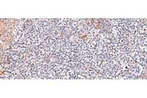 Immunohistochemistry of paraffin-embedded Human tonsil tissue using ITSN2 Polyclonal Antibody at dilution of 1:40(x200) (Intersectin 2 anticorps)